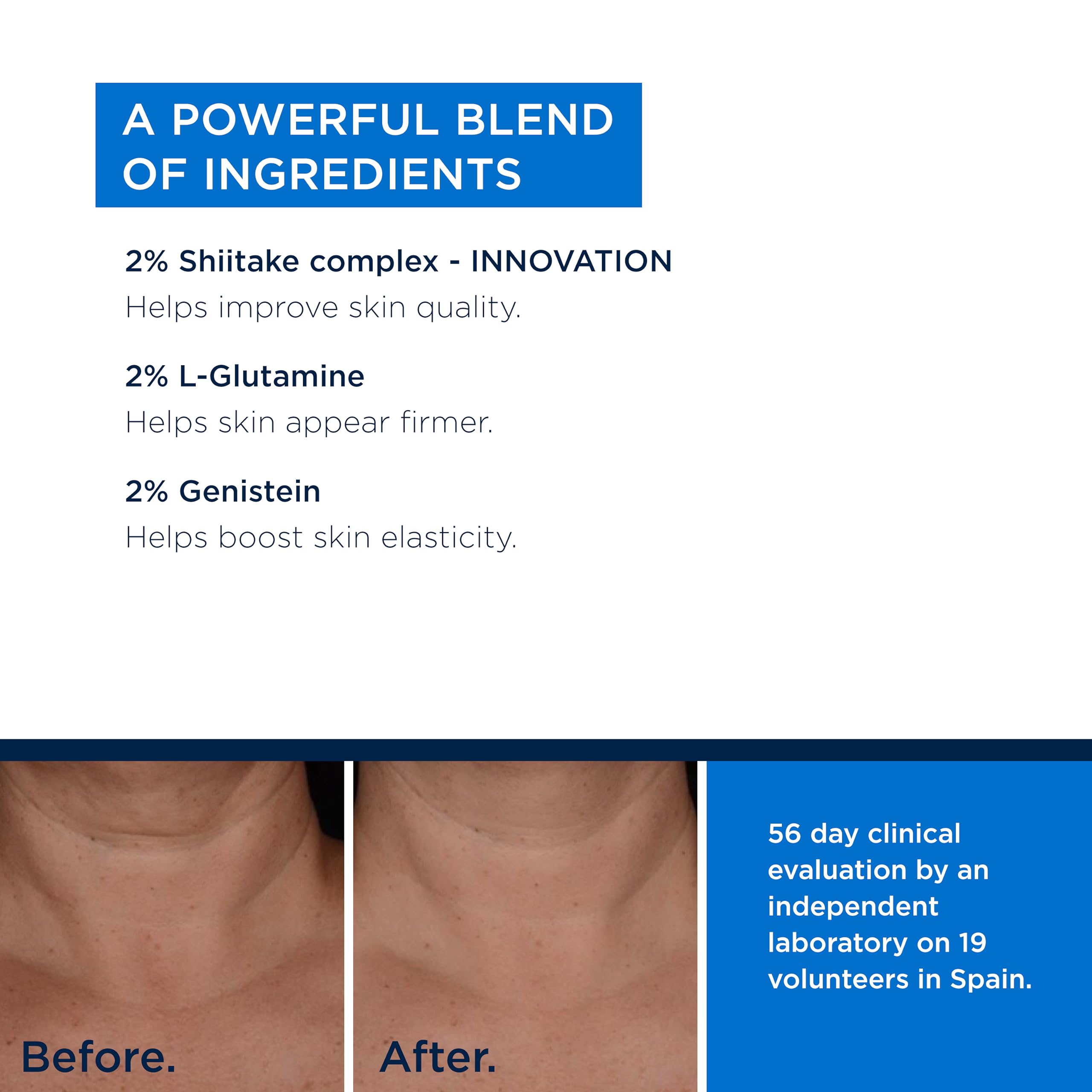Amazon.com: ALPHASCIENCE ULTRA FIRM Cream - Neck and Face